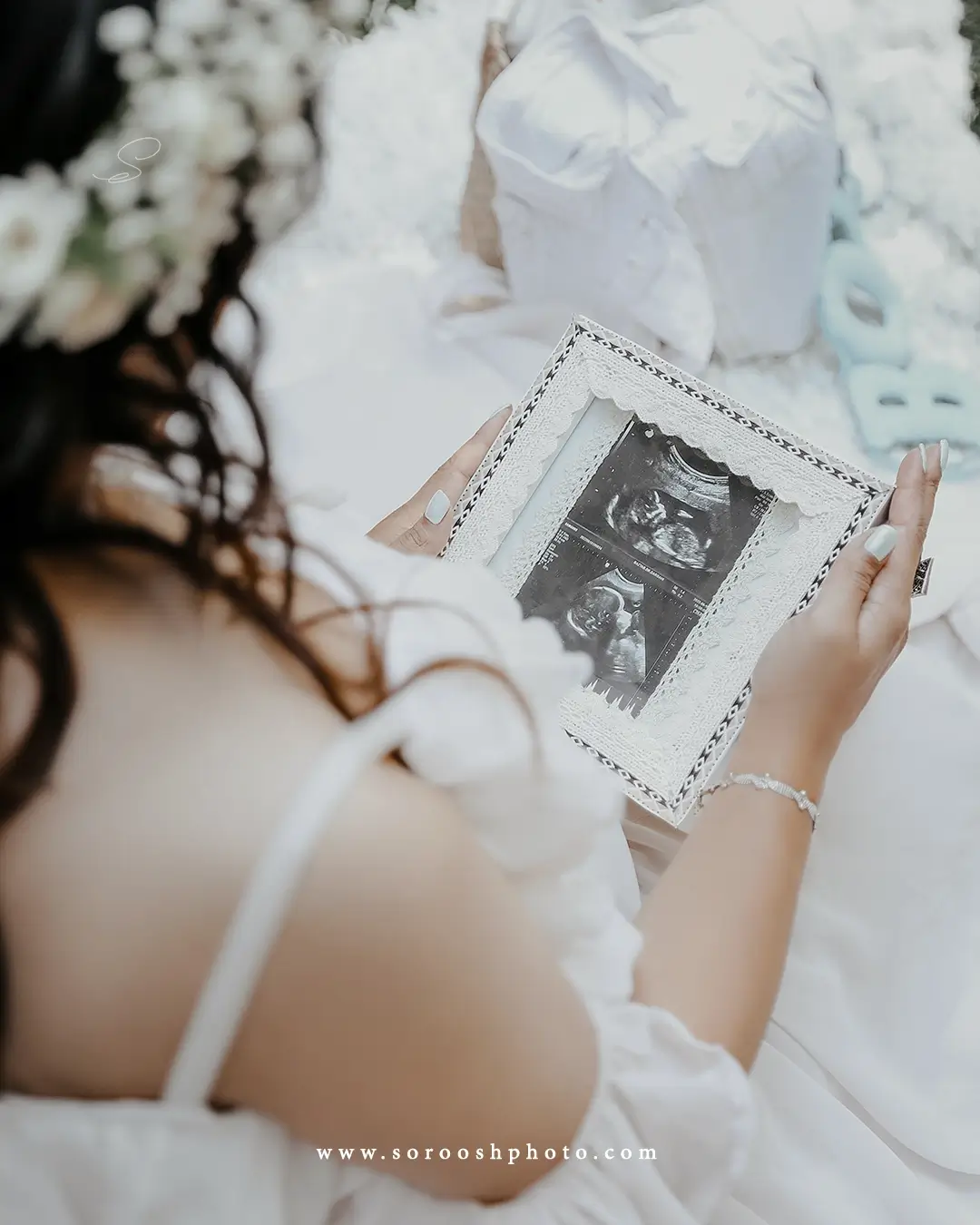 عکاسی بارداری با لباس تور و تصویر سونوگرافی